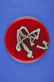 Das Bakterium Klebsiella oxytoca ist ein Darmkeim, der Krankheiten auslösen kann